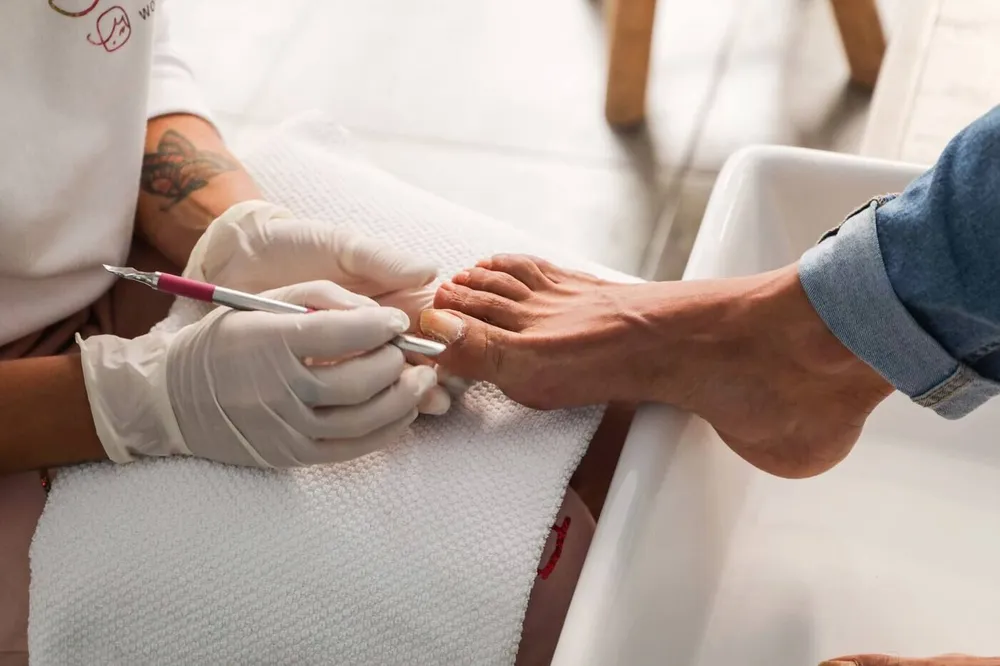 Podóloga con guantes tratando la uña del pie de un paciente con instrumental