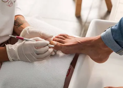 Podóloga con guantes tratando la uña del pie de un paciente con instrumental